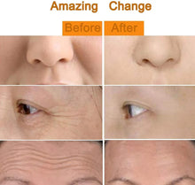 Load image into Gallery viewer, 🔥 HOT SALE 🔥 24K Gold T-Shape Vibrating Face Massager 🌟50% OFF🌟🌟