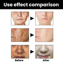 Load image into Gallery viewer, 🔥Acne, Scar Removal, Anti-Pigmentation, Plants essence, Wrinkless, Melanin Correcting Facial Serum
