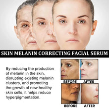 Load image into Gallery viewer, 🔥Acne, Scar Removal, Anti-Pigmentation, Plants essence, Wrinkless, Melanin Correcting Facial Serum