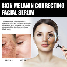 Load image into Gallery viewer, 🔥Acne, Scar Removal, Anti-Pigmentation, Plants essence, Wrinkless, Melanin Correcting Facial Serum