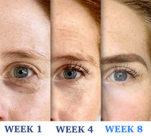 Load image into Gallery viewer, 🔥Imported Anti Ageing & Dark Circles Serum For Both Men & Women🔥Dermatologist Recommended