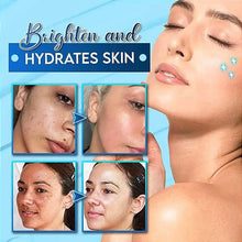 Load image into Gallery viewer, 🔥🔥Acne Removal Salicylic Acid Ice Cream Mask (Pack Of 2)🔥🔥For Both Men And Women