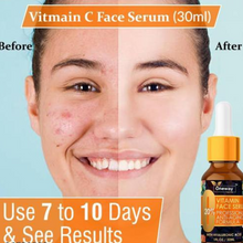 Load image into Gallery viewer, Imported Vitamin C Facial Serum- For Anti Aging & Smoothening & Brightening Face (For Both Men & Women) (🔥Buy 1 Get 1 Free🔥)