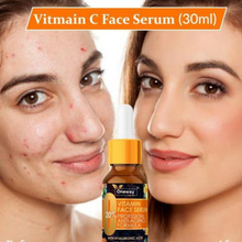 Load image into Gallery viewer, Imported Vitamin C Facial Serum- For Anti Aging & Smoothening & Brightening Face (For Both Men & Women) (🔥Buy 1 Get 1 Free🔥)