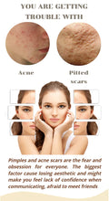 Load image into Gallery viewer, ⭐⭐⭐⭐⭐ (4.9/5) 💖100% ORIGINAL Niacinamide Facial Essence💖
