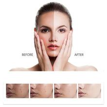 Load image into Gallery viewer, ❤️Imported Southern Xiehe Whitening Facial Cleanser - 🔥Buy 1 Get 1 Free🔥 - Pack Of 2
