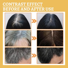 Load image into Gallery viewer, Anti-Greying Hair Serum (4.9 ⭐⭐⭐⭐⭐ 73,130 REVIEWS)
