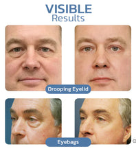 Load image into Gallery viewer, 🔥Imported Anti Ageing &amp; Dark Circles Serum For Both Men &amp; Women🔥Dermatologist Recommended
