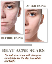 Load image into Gallery viewer, ⭐⭐⭐⭐⭐ (4.9/5) BY 1,57,456+ CUSTOMERS 🔥For the Last 100 Customers Only🔥 Niacinamide Facial Essence💖
